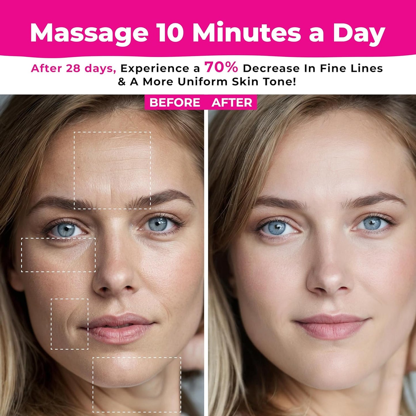 FaceRenew ™ Face Lifting LED Therapy Device